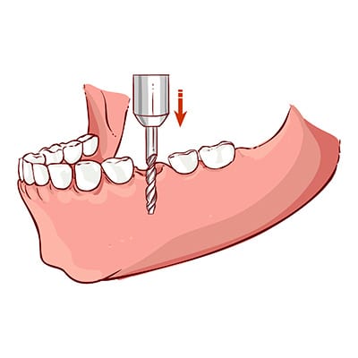 If you want to know a good dentist mount waverley’, be sure to know an excellent platform post thumbnail image