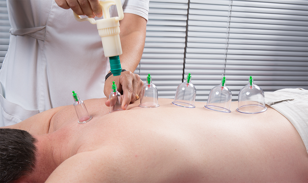 The benefits of Cupping Therapy Singapore post thumbnail image